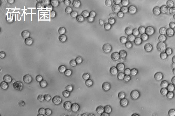 暴雨洪灾后的池塘如何处理，首先要修复池塘破损的地方