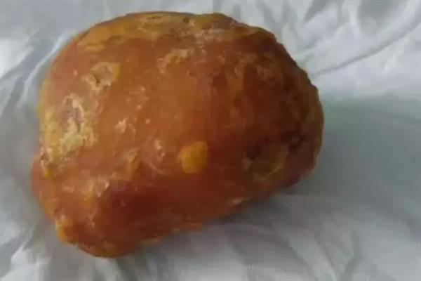 牛结石是不是牛黄，胆囊中的胆结石即为牛黄
