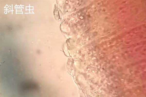 鱼鳃有寄生虫如何治疗，可以用小镊子将寄生虫拔除