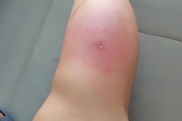 家里招马蜂的原因，可能是周围环境适合筑巢