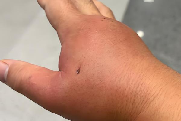 家里招马蜂的原因，可能是周围环境适合筑巢