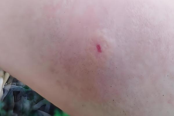 家里招马蜂的原因，可能是周围环境适合筑巢