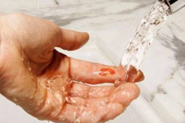 桂鱼有没有毒，身上的刺具有毒性