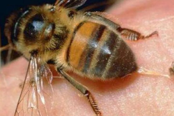 急性蜜蜂麻痹病的诱发病因，其病原是急性麻痹病毒