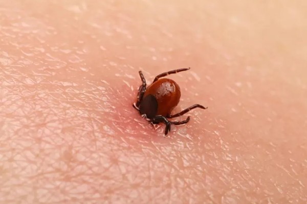 被蜱虫咬后有哪些症状，会导致发热、脏器功能减退等